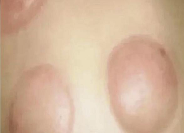 图片5.png 图片5.png